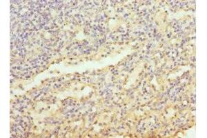Immunohistochemistry of paraffin-embedded human spleen tissue using ABIN7158640 at dilution of 1:100 (LY86 抗体  (AA 21-162))