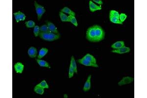 Immunofluorescence staining of HepG2 cells with ABIN7153223 at 1:140, counter-stained with DAPI. (FUOM 抗体  (AA 1-134))