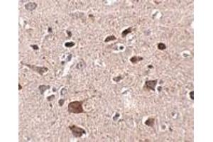 Immunohistochemistry of CCDC134 in human brain tissue with CCDC134 antibody at 2. (CCDC134 抗体  (N-Term))