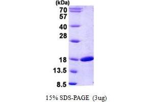 SDS-PAGE (SDS) image for Retinol Binding Protein 2, Cellular (RBP2) (AA 1-134) protein (His tag) (ABIN5852924) (RBP2 Protein (AA 1-134) (His tag))