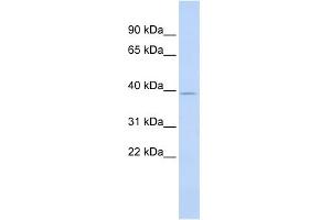 WB Suggested Anti-SAMD8 Antibody Titration: 0. (SAMD8 抗体  (Middle Region))
