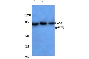 Western blot (WB) analysis of p-PKC ζ antibody at 1/500 dilution (PKC theta 抗体  (pSer676))