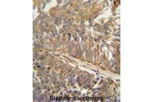 Immunohistochemistry (IHC) image for anti-ATPase Type 13A3 (ATP13A3) antibody (ABIN3002493) (ATP13A3 抗体)