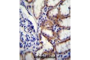Immunohistochemistry (Paraffin-embedded Sections) (IHC (p)) image for anti-Collagen, Type VIII, alpha 2 (COL8A2) (AA 578-607), (C-Term), (Chain alpha 2) antibody (ABIN951626)