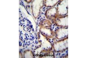 COL8A2 Antibody (C-term) immunohistochemistry analysis in formalin fixed and paraffin embedded human kidney tissue followed by peroxidase conjugation of the secondary antibody and DAB staining. (COL8a2 抗体  (C-Term, Chain alpha 2))