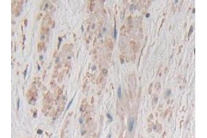 Immunohistochemistry (IHC) image for anti-Gastrokine 1 (GKN1) (AA 22-199) antibody (ABIN7434962)
