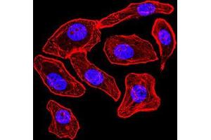 Immunocytochemistry (ICC) image for anti-Synapsin I (SYN1) (AA 362-511) antibody (ABIN5542390)