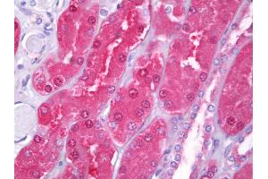 Anti-HIP1 antibody IHC of human kidney, tubules. (HIP1 抗体  (AA 928-1038))