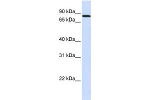 WB Suggested Anti-MAP4K2 Antibody Titration:  0. (MAP4K2 抗体  (N-Term))