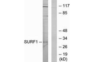Western blot analysis of extracts from Jurkat cells, using SURF1 Antibody. (SURF1 抗体  (AA 171-220))