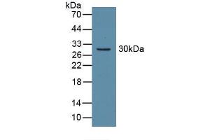 Western blot analysis of recombinant Mouse CA2. (CA2 抗体)
