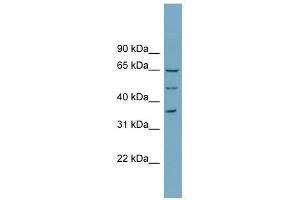WDR33 antibody used at 1 ug/ml to detect target protein. (WDR33 抗体  (N-Term))