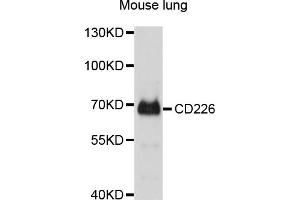 Western blot analysis of extracts of mouse lung, using CD226 antibody (ABIN4903182) at 1:1000 dilution. (CD226 抗体)
