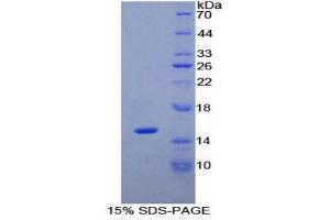 SDS-PAGE (SDS) image for Phospholipase A2-Activating Protein (PLAA) (AA 20-143) protein (His tag) (ABIN1171095)