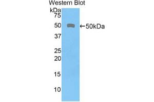 Western blot analysis of the recombinant protein. (CD46 抗体  (AA 136-341))