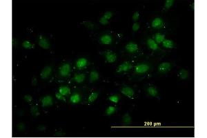 Immunofluorescence of monoclonal antibody to DNMT2 on HeLa cell. (Dnmt2 抗体  (AA 1-391))