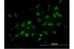 Immunofluorescence of monoclonal antibody to DNMT2 on HeLa cell.