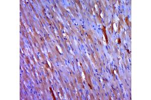 Immunohistochemistry (Paraffin-embedded Sections) (IHC (p)) image for anti-ATPase, Ca++ Transporting, Cardiac Muscle, Fast Twitch 1 (ATP2A1) (AA 101-200) antibody (ABIN872344)