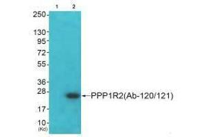 Western blot analysis of extracts from JK cells (Lane 2), using PPP1R2 (Ab-120/121) antiobdy. (PPP1R2 抗体  (Ser120, Ser121))