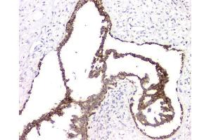 IHC analysis of RMI2 using anti-RMI2 antibody (ABIN6719656). (RMI2 抗体)