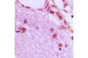 Immunohistochemical analysis of hnRNP H staining in human brain formalin fixed paraffin embedded tissue section. (HNRNPH1 抗体  (Center))