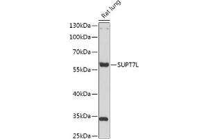 Western blot analysis of extracts of Rat lung, using SUPT7L antibody (ABIN7270646) at 1:1000 dilution. (SUPT7L 抗体  (AA 210-400))