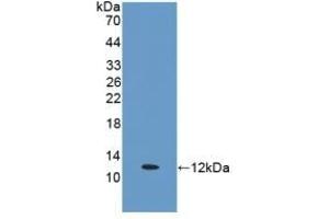 Detection of Recombinant ERb, Human using Polyclonal Antibody to Estrogen Receptor Beta (ERb) (ESR2 抗体  (AA 149-213))