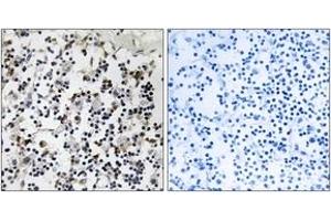 Immunohistochemistry analysis of paraffin-embedded human lymph node tissue, using CLIC4 Antibody. (CLIC4 抗体  (AA 1-50))