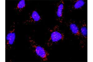 Proximity Ligation Analysis of protein-protein interactions between MAP3K14 and CHUK. (MAP3K14 抗体  (AA 1-947))