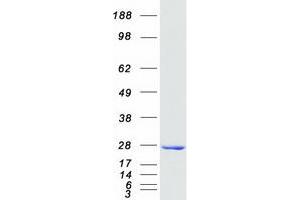 Western Blotting (WB) image for Adenylate Kinase 1 (AK1) protein (Myc-DYKDDDDK Tag) (ABIN2714401)