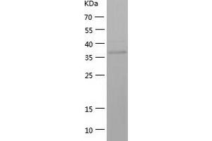 Western Blotting (WB) image for Aldo-keto Reductase Family 1 Member C4 (AKR1C4) (AA 1-343) protein (His tag) (ABIN7121778) (AKR1C4 Protein (AA 1-343) (His tag))