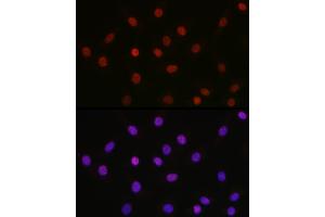 Immunofluorescence analysis of NIH-3T3 cells using [KO Validated] Acetyl-HMGB1-K29 Rabbit pAb (ABIN7267647) at dilution of 1:100 (40x lens). (HMGB1 抗体  (acLys29))