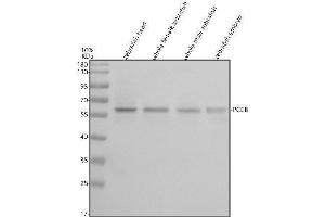 Western blot analysis of PCCB using anti-PCCB antibody (AZB0V0X1).