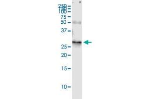 Immunoprecipitation of RAB32 transfected lysate using rabbit polyclonal anti-RAB32 and Protein A Magnetic Bead ( U0007 ), and immunoblotted with mouse purified polyclonal anti-RAB32. (RAB32 (人) IP-WB Antibody Pair)