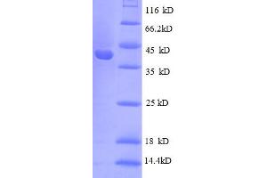 SDS-PAGE (SDS) image for Ribosomal Protein S10 (RPS10) (AA 1-103), (full length) protein (GST tag) (ABIN5712610)