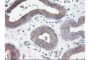 Image no. 1 for anti-ATG3 Autophagy Related 3 (ATG3) antibody (ABIN1496760) (ATG3 抗体)