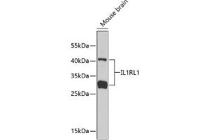 Western blot analysis of extracts of mouse brain, using IL1RL1 antibody . (IL1RL1 抗体  (AA 19-328))