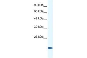 Western Blotting (WB) image for anti-Cysteine and Glycine-Rich Protein 3 (CSRP3) antibody (ABIN2460883) (CSRP3 抗体)