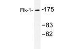 Western blot analysis of Flk-1 antibody in extracts from HepG2 cells. (VEGFR2/CD309 抗体)