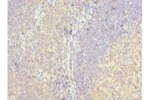 Immunohistochemistry of paraffin-embedded human tonsil tissue using ABIN7158640 at dilution of 1:100 (LY86 抗体  (AA 21-162))