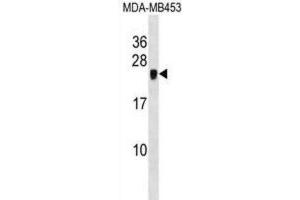Western Blotting (WB) image for anti-Cysteine-Rich Protein 2 (CRIP2) antibody (ABIN2998781) (CRIP2 抗体)