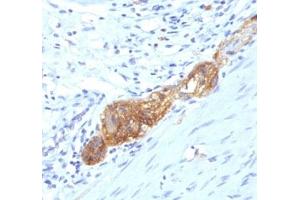 Formalin-fixed, paraffin-embedded human colon stained with anti-CD56 antibody (SPM489) (Neurofilament 抗体  (Extracellular Domain))