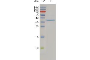 SDS-PAGE (SDS) image for Claudin 3 (CLDN3) (AA 30-80) protein (Fc Tag) (ABIN6964182)