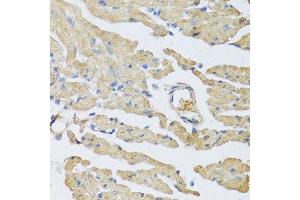 Immunohistochemistry of paraffin-embedded mouse heart using UCN2 antibody at dilution of 1:100 (40x lens). (Urocortin 2 抗体)