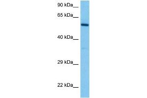 Host:  Mouse  Target Name:  DAB2  Sample Tissue:  Mouse Spleen  Antibody Dilution:  1ug/ml (DAB2 抗体  (N-Term))