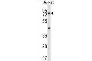 Western Blotting (WB) image for anti-Mucolipin 1 (MCOLN1) antibody (ABIN2997394) (MCOLN1 抗体)