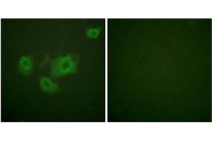 Immunofluorescence analysis of HuvEc cells, using Kir6. (KCNJ11 抗体  (pThr224))