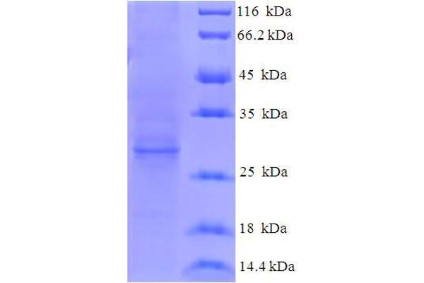 HEV ORF3 Protein (AA 1-114, full length) (His-SUMO Tag)