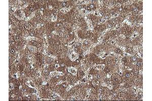 Image no. 1 for anti-Cancer/testis Antigen 1B (CTAG1B) antibody (ABIN1499896) (CTAG1B 抗体)