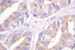 Image no. 2 for anti-V-Raf Murine Sarcoma 3611 Viral Oncogene Homolog (ARAF) antibody (ABIN271994)